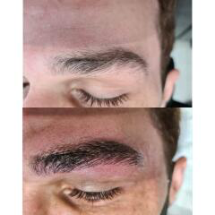 Micropigmentation and microblading